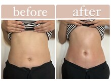 メグリア(MEGURIA)/内側が変われば外側も変わる