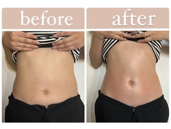 メグリア(MEGURIA)/内側が変われば外側も変わる