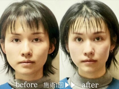 小顔矯正アンドフェイシャルサロン アンベリール(embellir)の写真