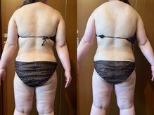 マロカ(Marroka)の雰囲気（40代前半。エンダ＋若よもぎ蒸し1回！！）