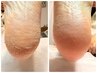 【6週間以内に再来の方】継続がカギ☆角質トータルケア￥6,000