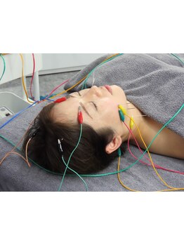 鍼灸施術を受けたい