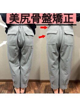 ブラックスワン(Black Swan)/