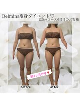 ベルミナ(Belmina)/大名/天神/毛穴/脱毛/痩身