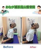 おなが浦添当山整骨院/クビの可動域、劇的改善！！