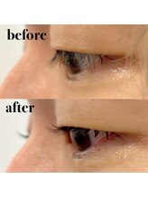 エン(EN)/まつ毛パーマで逆まつげ改善