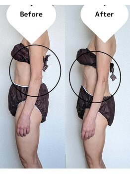 サロン ド ベルメール(Salon de Belle mer)/リンパマッサージ/痩身/リンパ