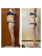 美ボディラボ(美Body Labo)/痩身なら美Body Labo藤沢店★