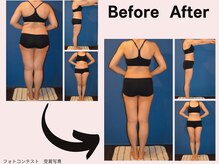 ミネルバエンダモロジー/エンダモロジー/痩身/ウェルネス