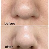 アニッシュ(ANISH)