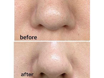 アニッシュ(ANISH)