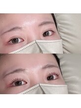 ロレインブロウ 木更津店/まつ毛パーマ【木更津/まつげ】