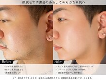 テディベース(TEDDY BASE)の雰囲気（顔脱毛/髭脱毛/脱毛/北堀江/南堀江/四ツ橋/心斎橋）