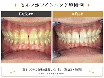 ピュアホワイトニング 横浜店の写真/【医療提携】感動の白さを実感できるセルフホワイトニングサロン♪ペア、メンズのご来店も大歓迎です◎