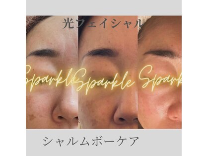バリエステ シュクルの写真