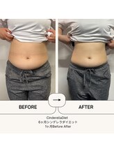 オーシャン整骨院(OCEAN整骨院)/６ヶ月コース