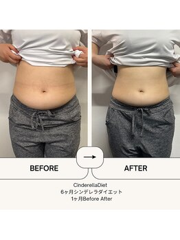 オーシャン整骨院(OCEAN整骨院)/６ヶ月コース