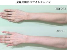 サンビ(SANBI)/肌本来の白さに