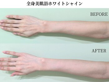 サンビ(SANBI)/肌本来の白さに