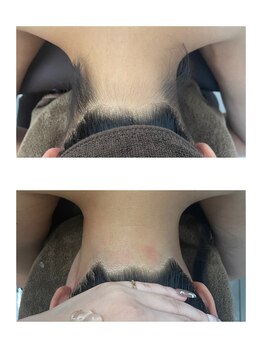 ミース 北九州店/うなじ★ビフォーアフター