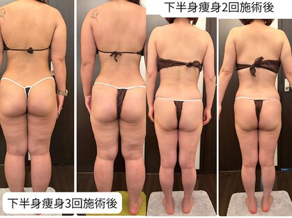 リ ビューティ リバティ(Re:Beauty LIBERTY)の写真