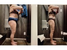 パーフェクトボディプレミアム 札幌駅前店(PERFECT BODY PREMIUM)/お客様　ビフォーアフター（9）