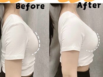 リングケー(Ling K)/バストアップ