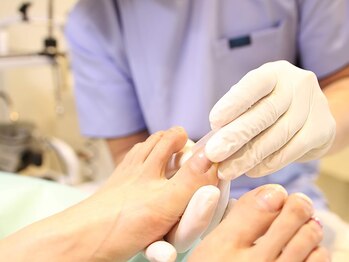 巻き爪補正店 北千住店の写真/巻き爪のスペシャリストによる施術で長年の爪の悩みを解消！【カウンセリング込☆巻き爪補正1回¥5500】