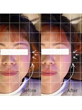 ベルルーナ(Belle-Lune)/ビフォーアフター