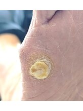 001 新横浜/ひどいタコも一回で