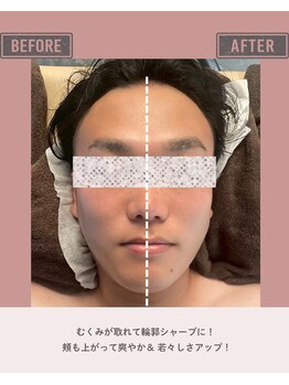 マーリエ(Malie)/【メンズ小顔】