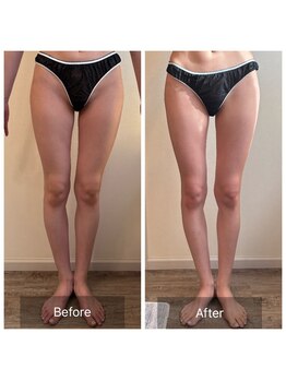 エヌア(nA)/2ヶ月プラン♪20代痩身全身！