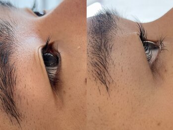 レレガンス(LELEGANCE)/メンズ逆まつげ改善