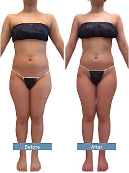 パルフェット(parfaite)/全身スッキリ