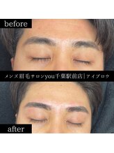 ユー 千葉駅前店(you)/ビフォ－アフター写真