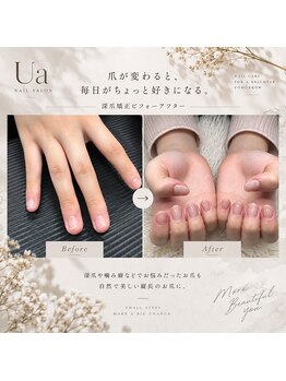 ウア(Ua)の写真/大切な日の前に！爪のお悩みもUaにおまかせ♪深爪などでお悩みの方は一度ご相談ください。