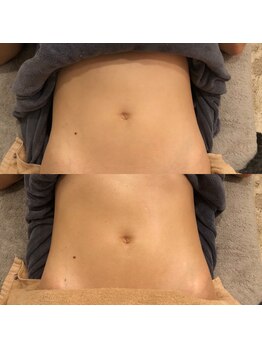 ニューミー スパ(newme spa)/腸セラピーでゆるまるお腹。