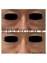 エヴァーグレース 川崎店/改善実績多数！目元ケアコース