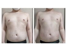 痩身 脱毛専門サロン 椿の雰囲気（メンズ痩身ダイエット！脂肪冷却／キャビテーション／脂肪分解）