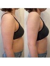 ハル 水戸市(HaRu)/