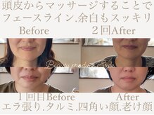 スティル(Style)の雰囲気（老け顔 エラ張り タルミ 四角いお顔 頬の余白スッキリ解消小顔へ）