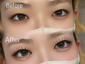 ポース(phoOs)/奥二重さんアンドヘルシー