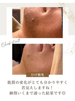 ヒーリングリゾート ナゴミ(Nagomi)/ひげ脱毛