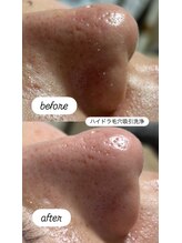 シロ(SHIRO)/毛穴の黒ずみざらつき