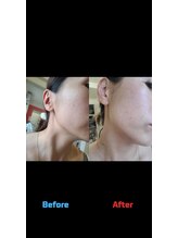 ティックサロン(tic.salon)/ハーブトリートメント前後☆