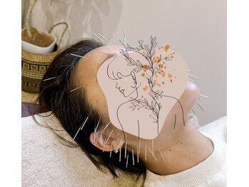 あんどら鍼灸接骨院/大人気美容鍼メニューあり◎