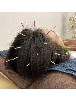 ブロッサム(Blossom)/頭痛改善、抜け毛予防にも◎