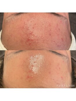 エクラ(eclat)/クリスティーナ