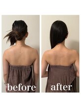 ルビー 池袋店(Ruby)/ブライダル前の小顔、姿勢矯正