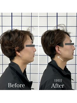 クローバー整体院/小顔整体（施術1回）